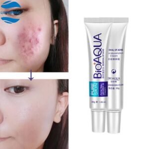 BIOAQUA Acne Cream - Fast-Acting Treatment for Clear, Blemish-Free Skin | TrendMal.com